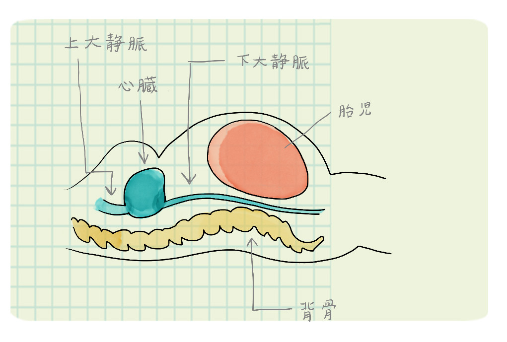 妊娠中の 5 種類の睡眠姿勢